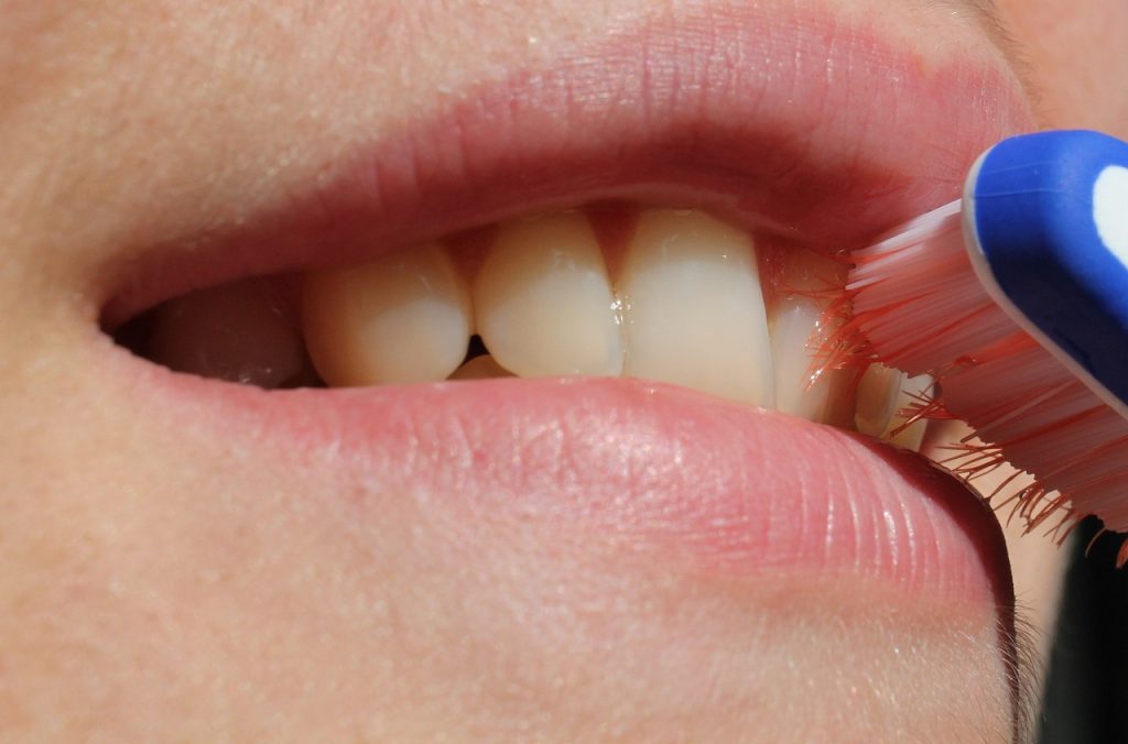 Can A Chipped Tooth Wait For Treatment?