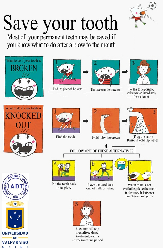 What Should I Do If My Tooth Gets Knocked Out?